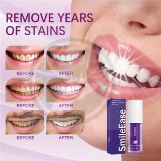 Serum làm Trắng Răng Smilekit V34 Kem Đánh Răng Tẩy Trắng Răng Tại Nhà