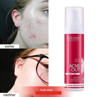 [ Hàng Nhập Khẩu ] Biotrade Lotion dung dịch chấm mụn, gom cồi, kiềm dầu
