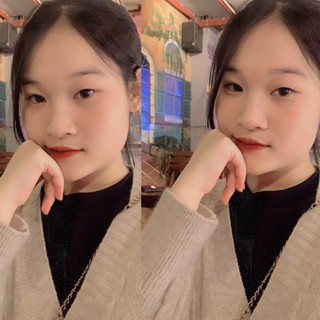 Vật tư nha khoa quốc tế